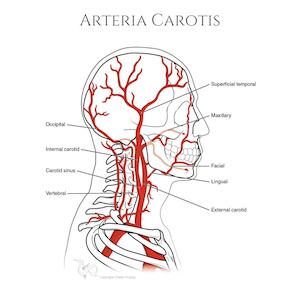 Arteria-Carotis